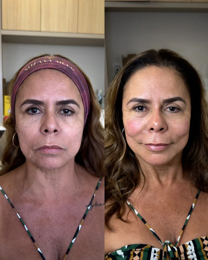 Resultado antes e depois 1