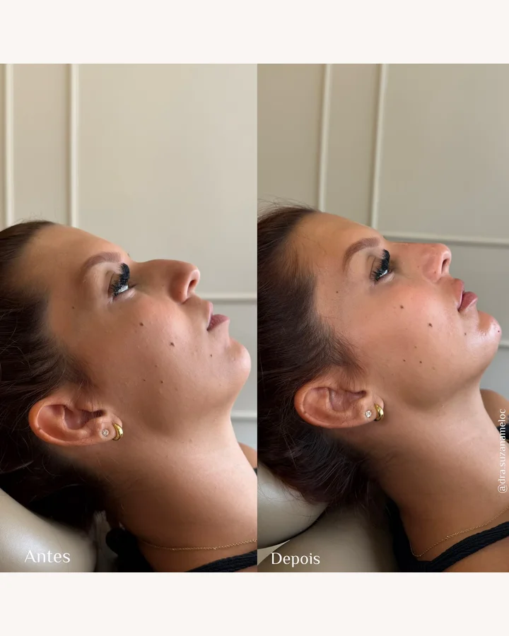 Resultado antes e depois 4